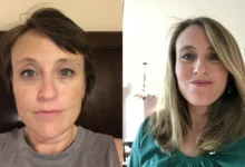 what helps hair growth after chemo